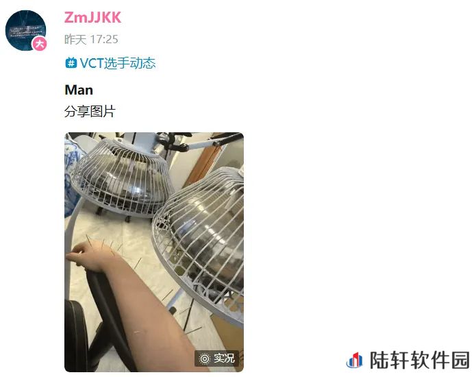 快点恢复哇！ZmjjKK选手分享针灸理疗照片